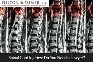 spinal cord injuries