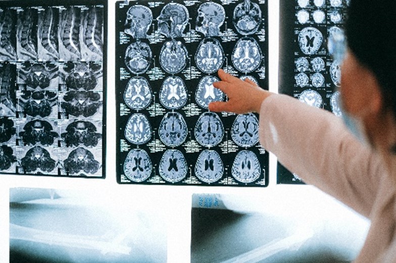Common Causes of Traumatic Brain Injury